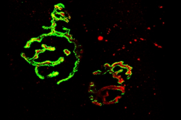 Microscopy image of a neuromuscular junction