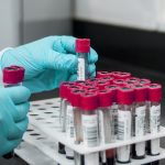 Researcher wearing gloves arranging blood sample tubes in a rack