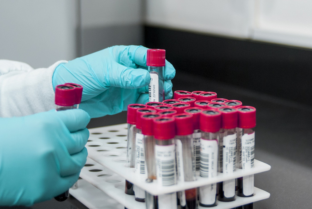 Researcher wearing gloves arranging blood sample tubes in a rack