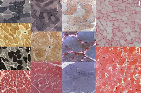 Image of stained muscle sections using different staining techniques